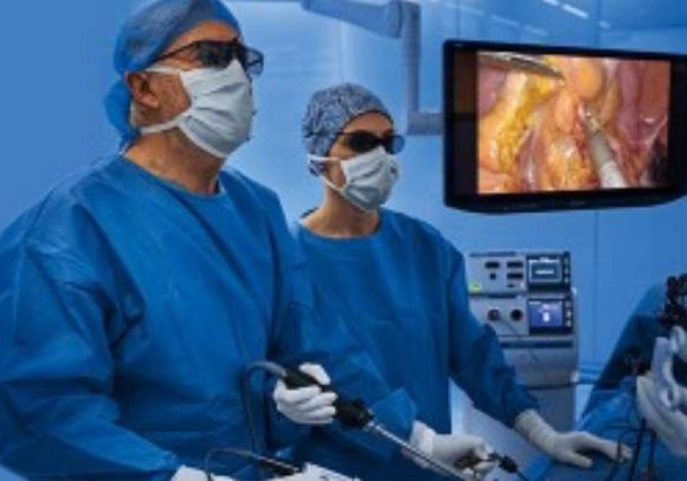 Laproscopic-surgery-2